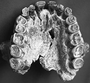 ホモ・ハビリスの歯1